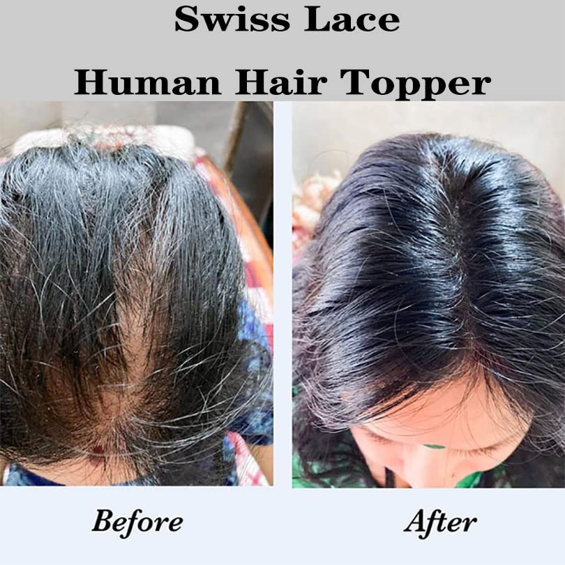 Lush Locks Lace Hair Topper for Thinning Hair