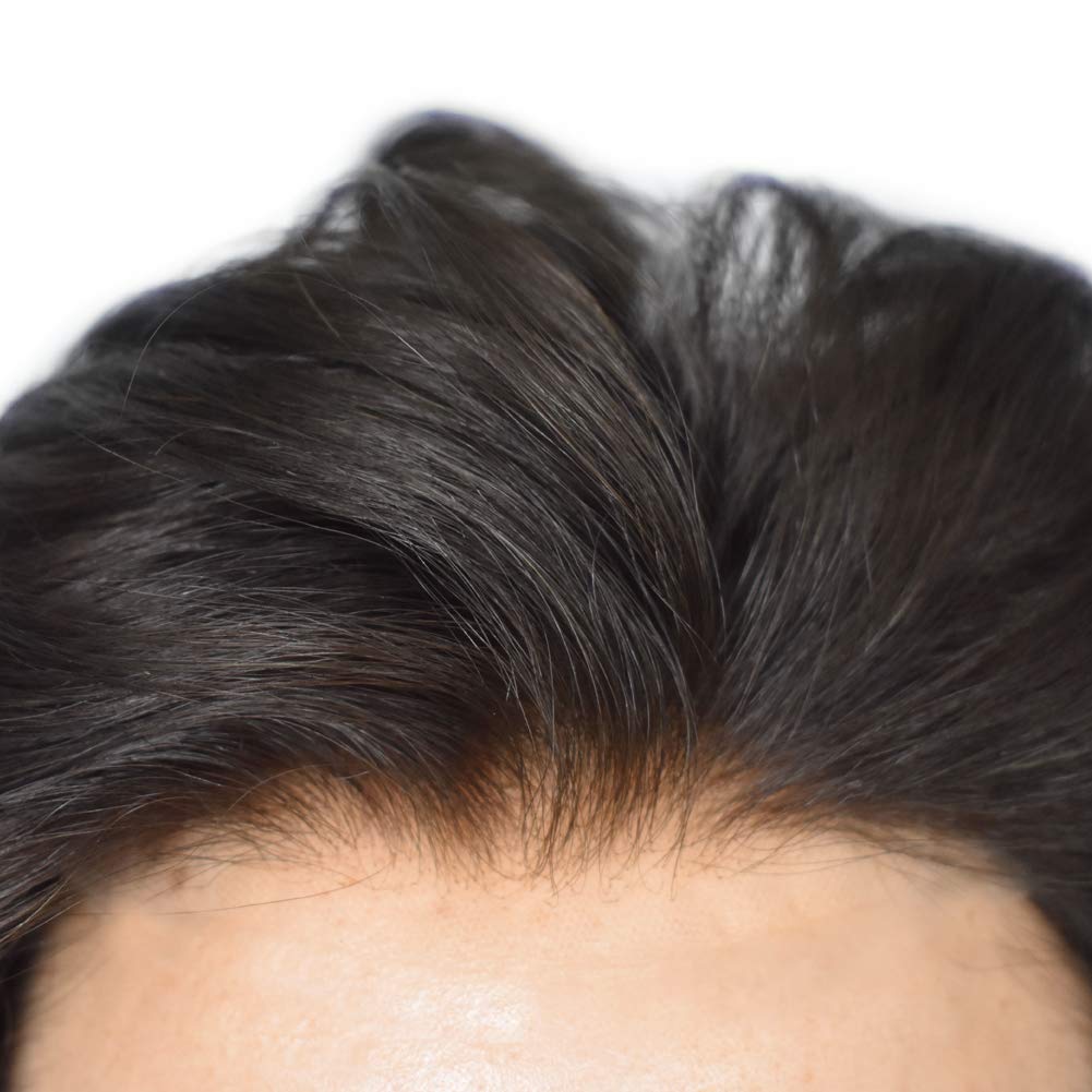 Lush Locks Hair System French Lace Q6 Hair Patch/ Hair System for Men
